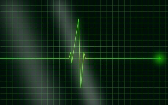 Imagem de um eletrocardiograma