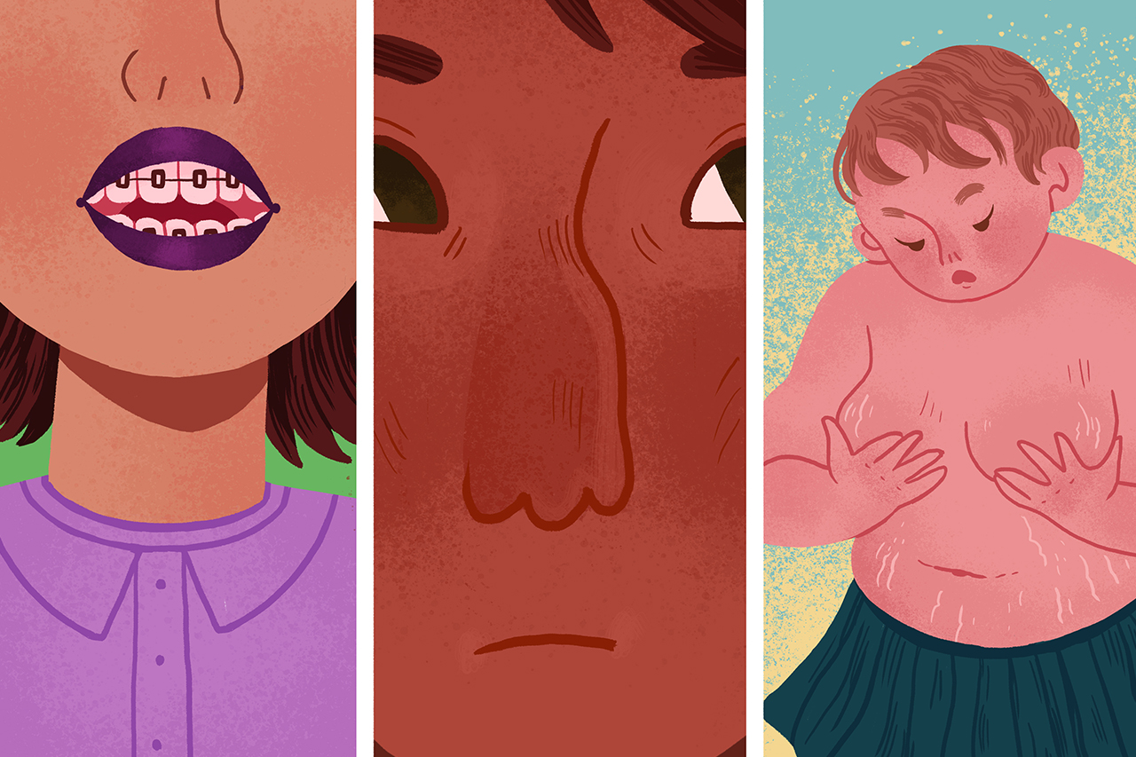 Ilustra&ccedil;&atilde;o de tr&ecirc;s alunos preocupados com suas mudan&ccedil;as corporais relacionadas &agrave; apar&ecirc;ncia f&iacute;sica como o tamanho do nariz, necessidade do uso de aparelhos ou peso.